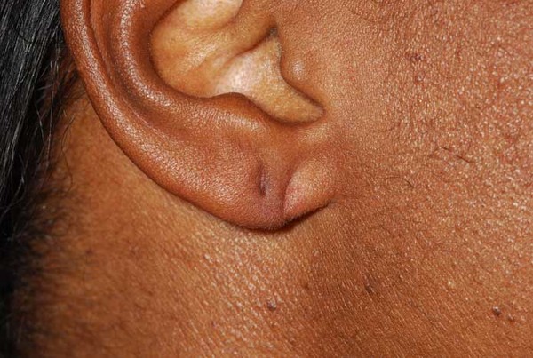 Những người có dái tai nhỏ thường ít nhận được thiện cảm từ mọi người