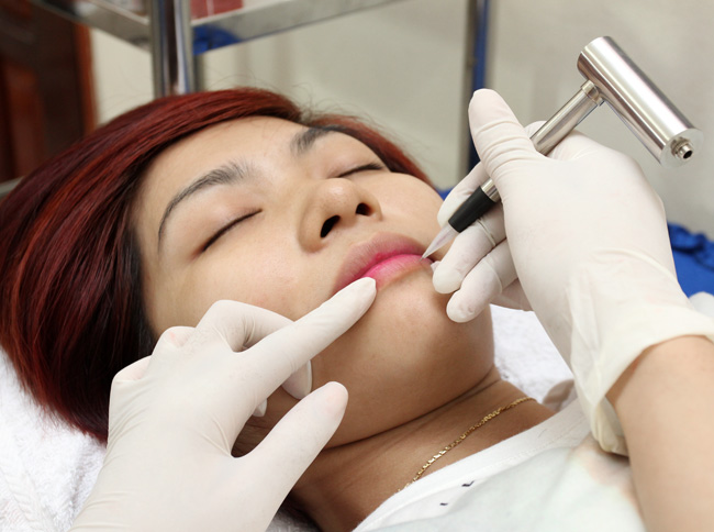 Thời gian phun môi khoảng 20 phút – 30 phút