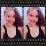  Sau 12 ngày nâng mũi lần thứ 3, điều Thu Thảo nuối tiếc nhất…