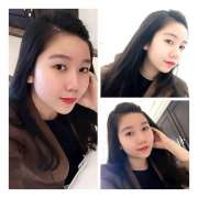  Nâng mũi tự nhiên hay cao tây, Ngọc Diệp chia sẻ sau 6 năm nâng mũi nhấn mí 