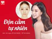  Độn cằm tự nhiên dễ như ăn kẹo 