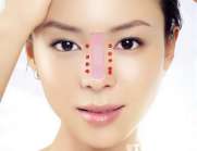 Miếng dán nâng mũi - bí ẩn đằng sau chiếc mũi cao không cần phẫu thuật 