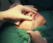  Này, dừng ngay việc tạo môi trái tim không phẫu thuật đi em