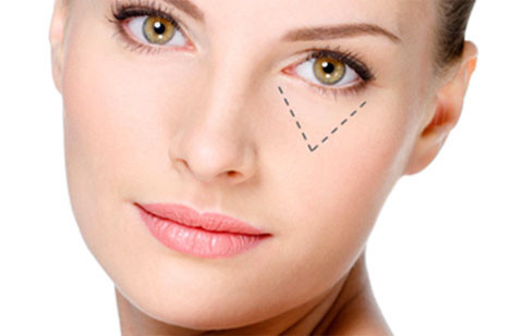 Sau cắt mí dưới, đôi mắt của bạn sẽ trở nên đẹp hơn