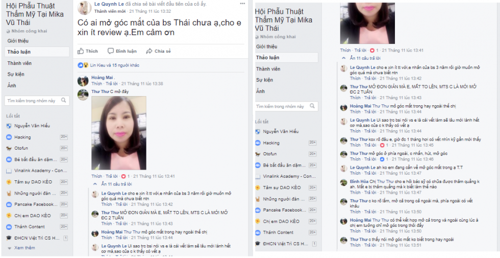 Mở rộng góc mắt ở đâu đẹp